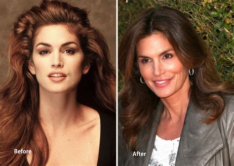 Cindy Crawford: My 11 years of cosmetic surgery